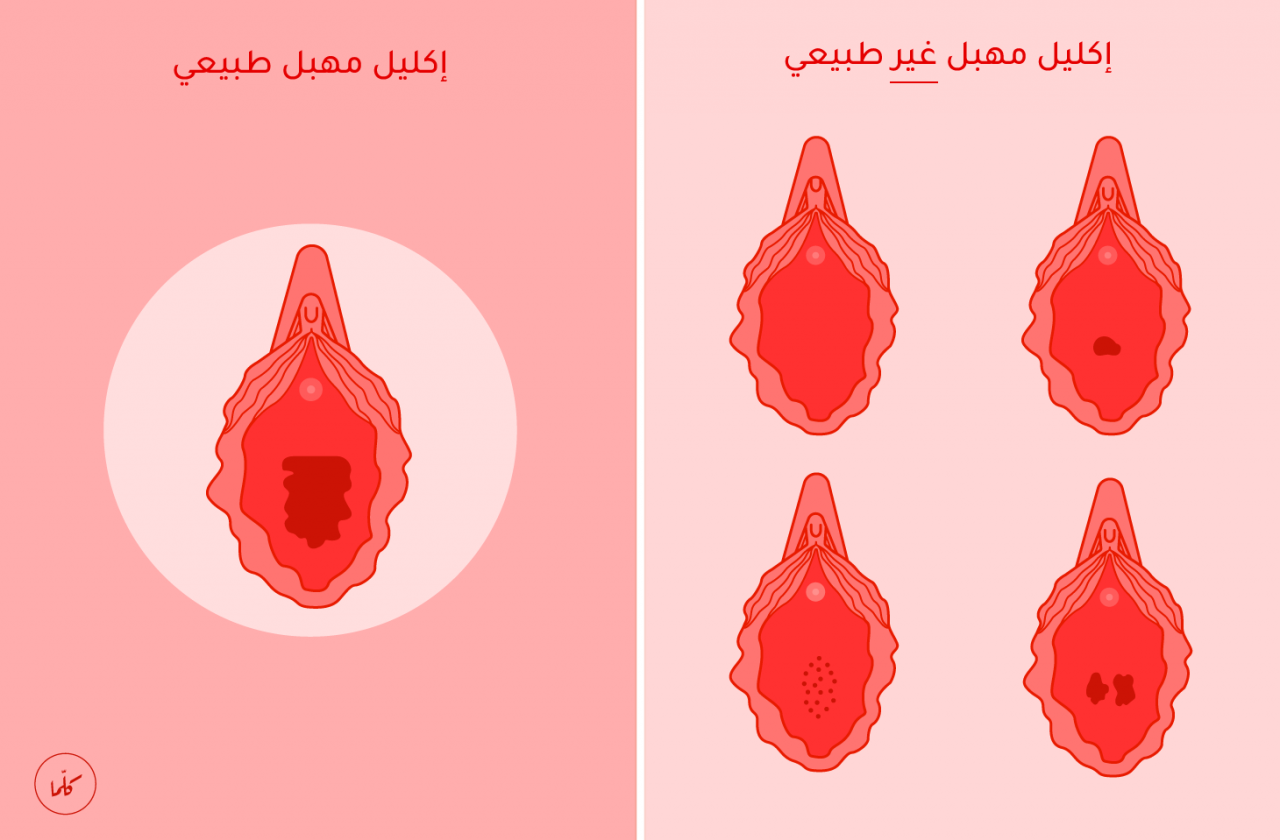 معرفة حجم المهبل - طريقه معرفه حجم المهبل 103 1