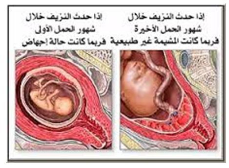 التهابات المهبل اثناء الحمل - اسباب الشعور بالحكه في المهبل 3166 3