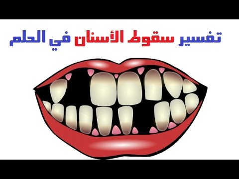 رؤية تساقط الاسنان في المنام , اسنانى وقعت في حلمى