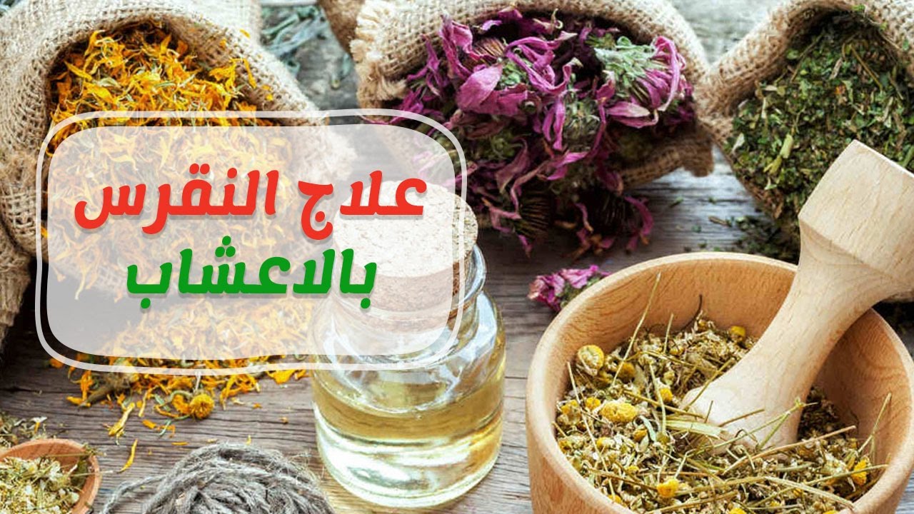 علاج النقرس بالاعشاب مجرب , فوائد الاعشاب فى علاج الكثير من الامراض