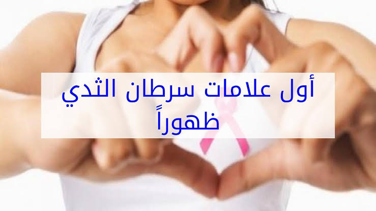 ماهي اعراض سرطان الثدي المبكرة , اشهر اعراض لسرطان الثدى