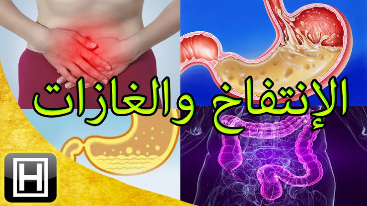 افضل علاج للقولون العصبي والغازات - تخلص من كل اعراض القولون 3988 3