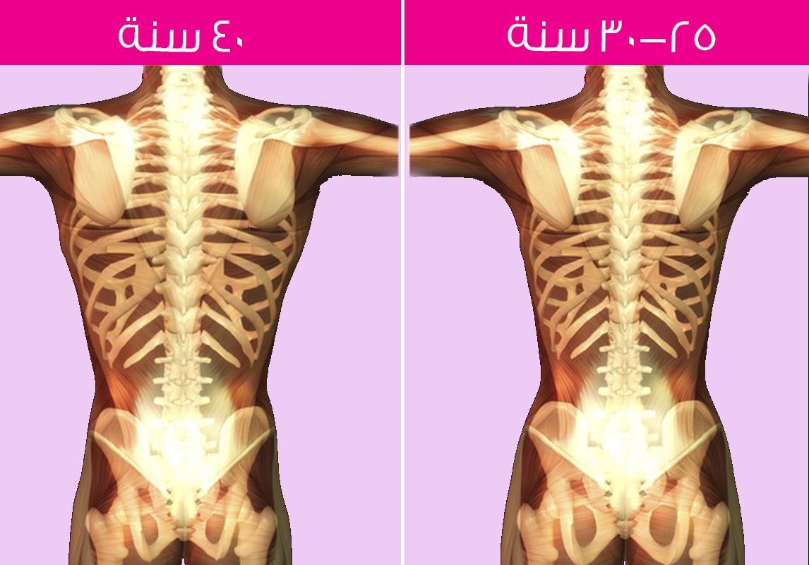 هرمون تكبير العظام , اكل صحى عظام اقوى